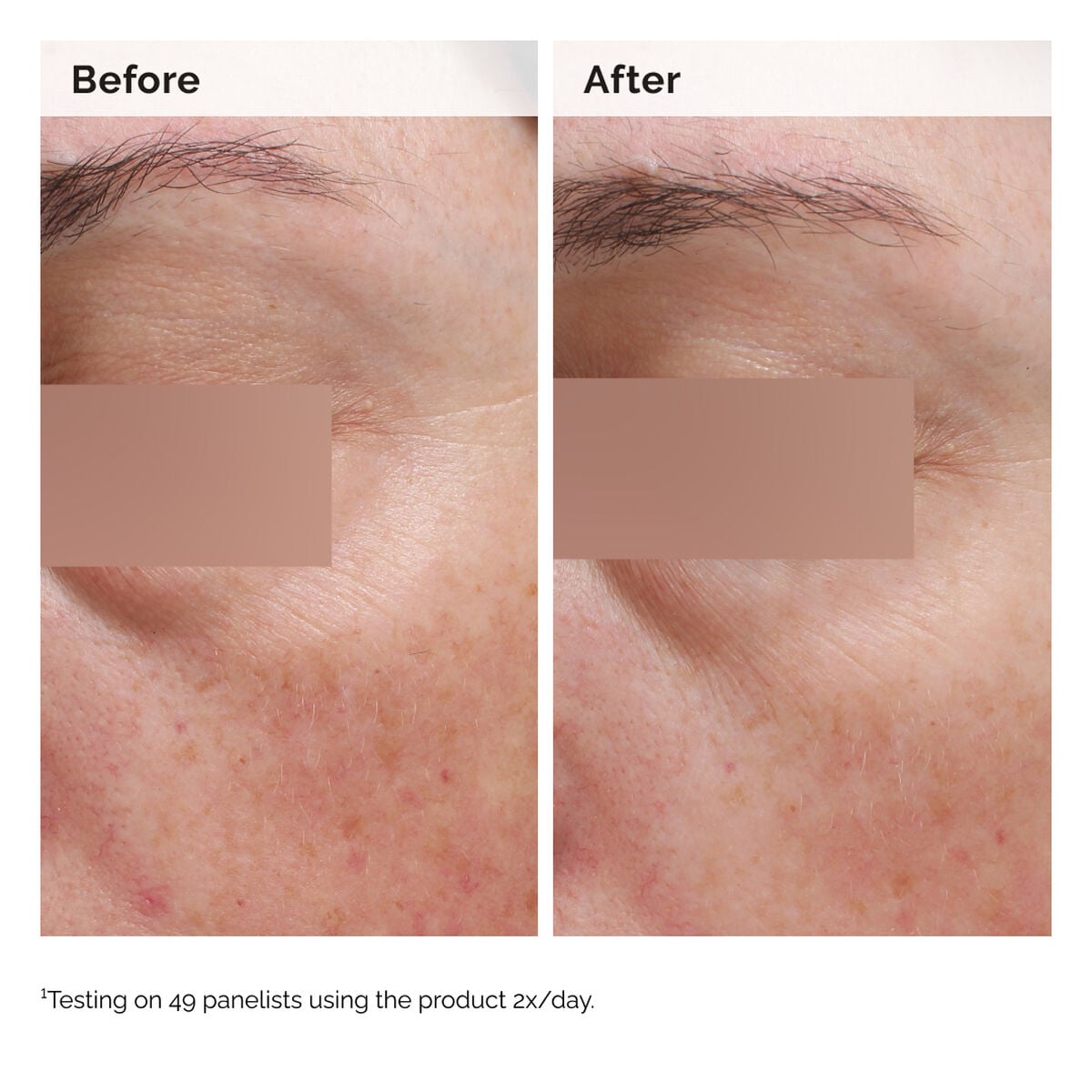 niacinamide-5-face-and-body-emulsion-j3 2024-08-23-ORD-Nia-5pct-Face-Body-B-A-Elasticity-Global-02-1x1.jpg