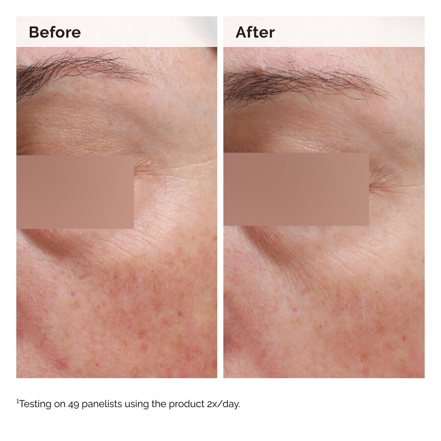 niacinamide-5-face-and-body-emulsion-j3 2024-08-23-ORD-Nia-5pct-Face-Body-B-A-Elasticity-Global-02-1x1.jpg