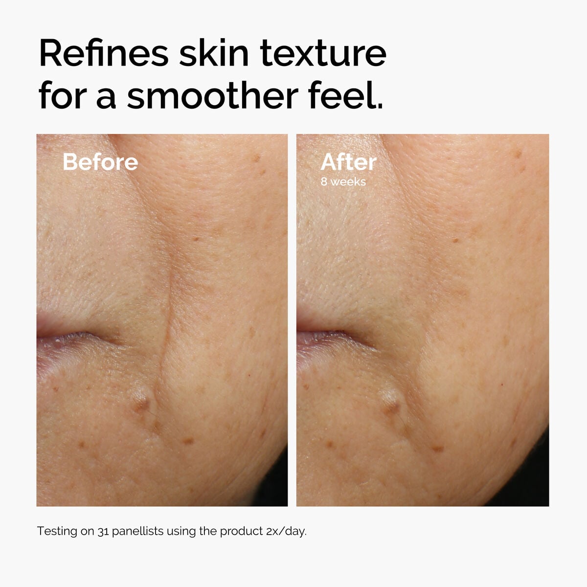 caffeine-3-escin-1-face-serum-b2 ord-caffeine-3pct-escin-1pct-face-serum-before-after-texture.jpg