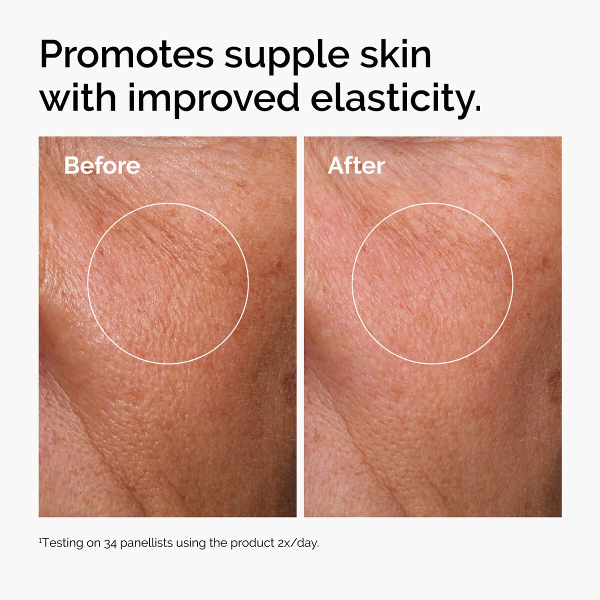hyaluronic-acid-2-b5-with-ceramides-l5 ord-hyaluronic-acid-2pct-b5-hydrating-serum-before-after-elasticity.jpg