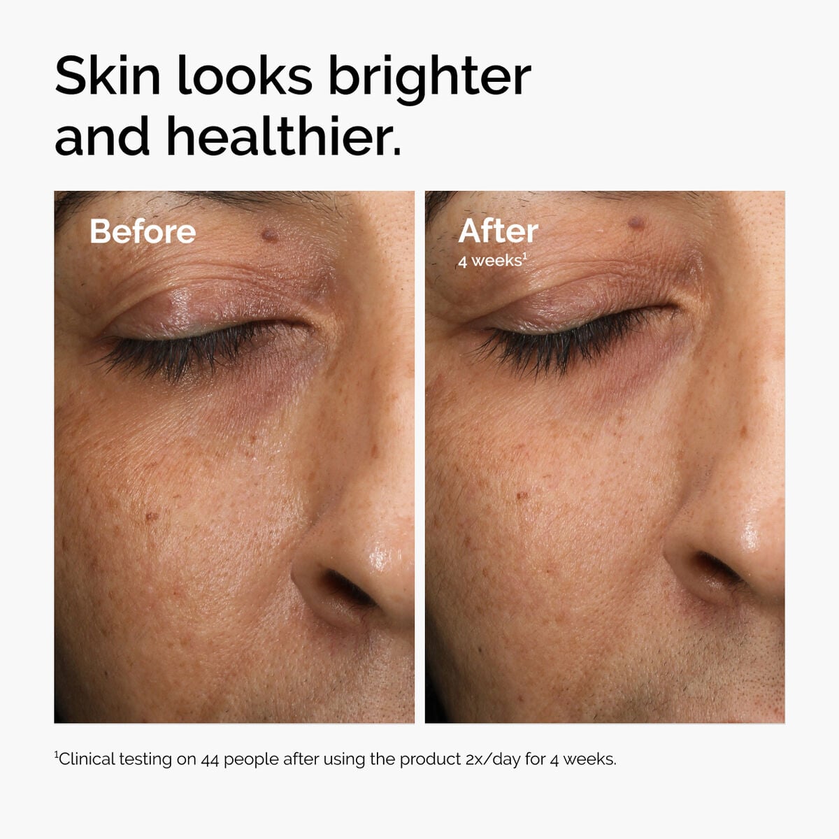 multi-antioxidant-radiance-serum-e4 ord-mars-before-after-healthy.jpg