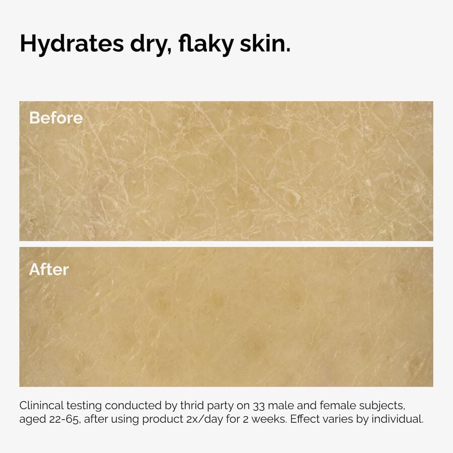 the-body-care-collection-h3 ord-natural-moisturizing-factors-inulin-body-before-after-graphic-02.jpg