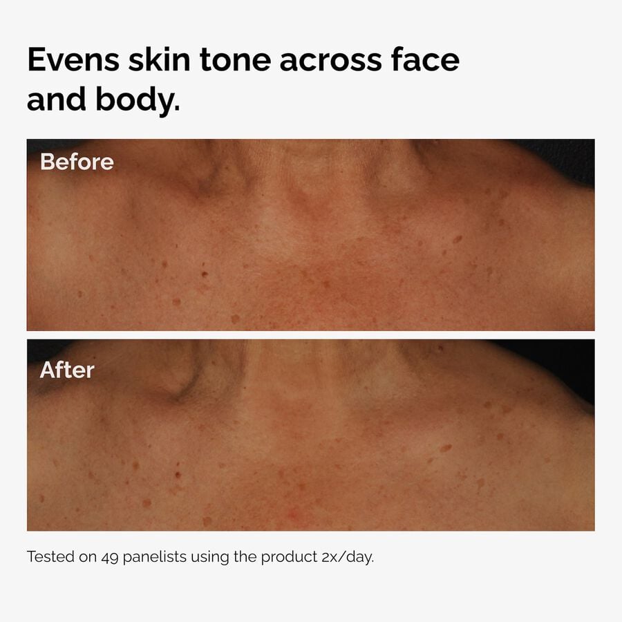 the-body-care-collection-h3 ord-niacinamide-face-body-serum-before-after-even-tone-graphic.jpg