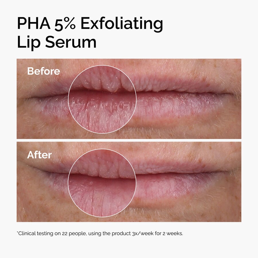 pha-5-exfoliating-lip-serum-j7 ord-pha-5pct-lip-exfoliating-serum-before-after.jpg