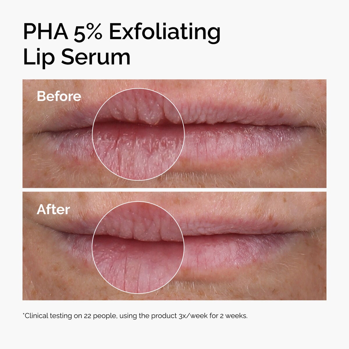 pha-5-exfoliating-lip-serum-j7 ord-pha-5pct-lip-exfoliating-serum-before-after.jpg