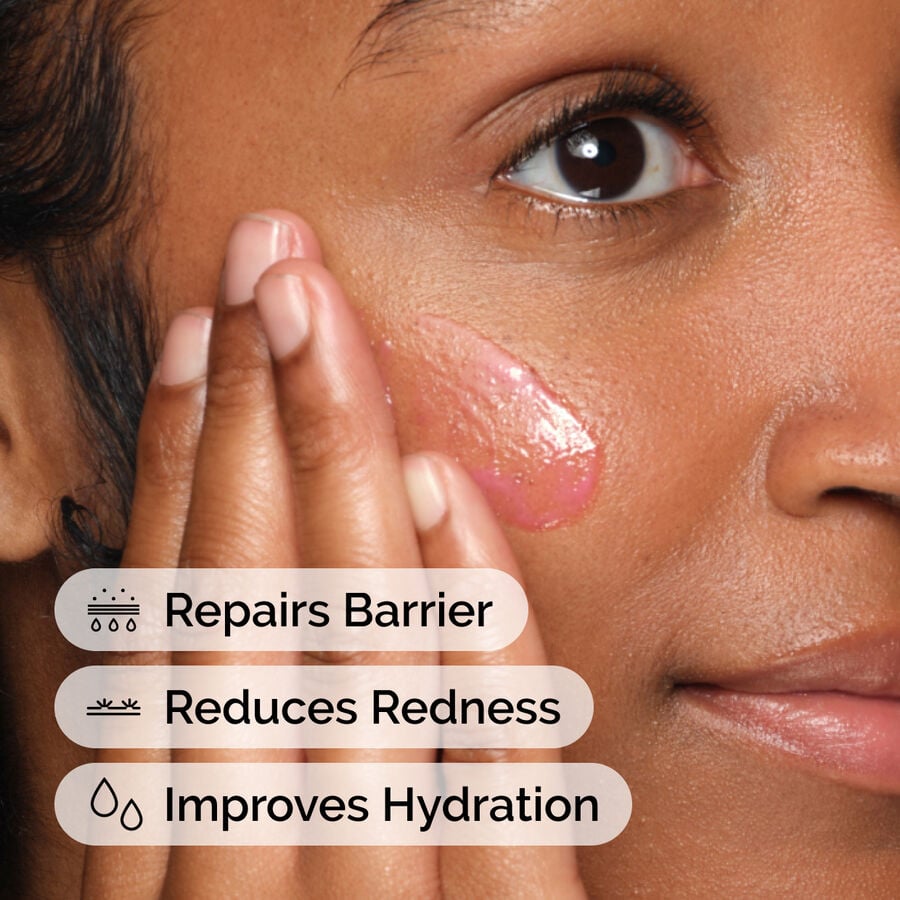 soothing-and-barrier-support-serum-q8 ord-soothing-barrier-support-serum-model-application-with-benefits.jpg